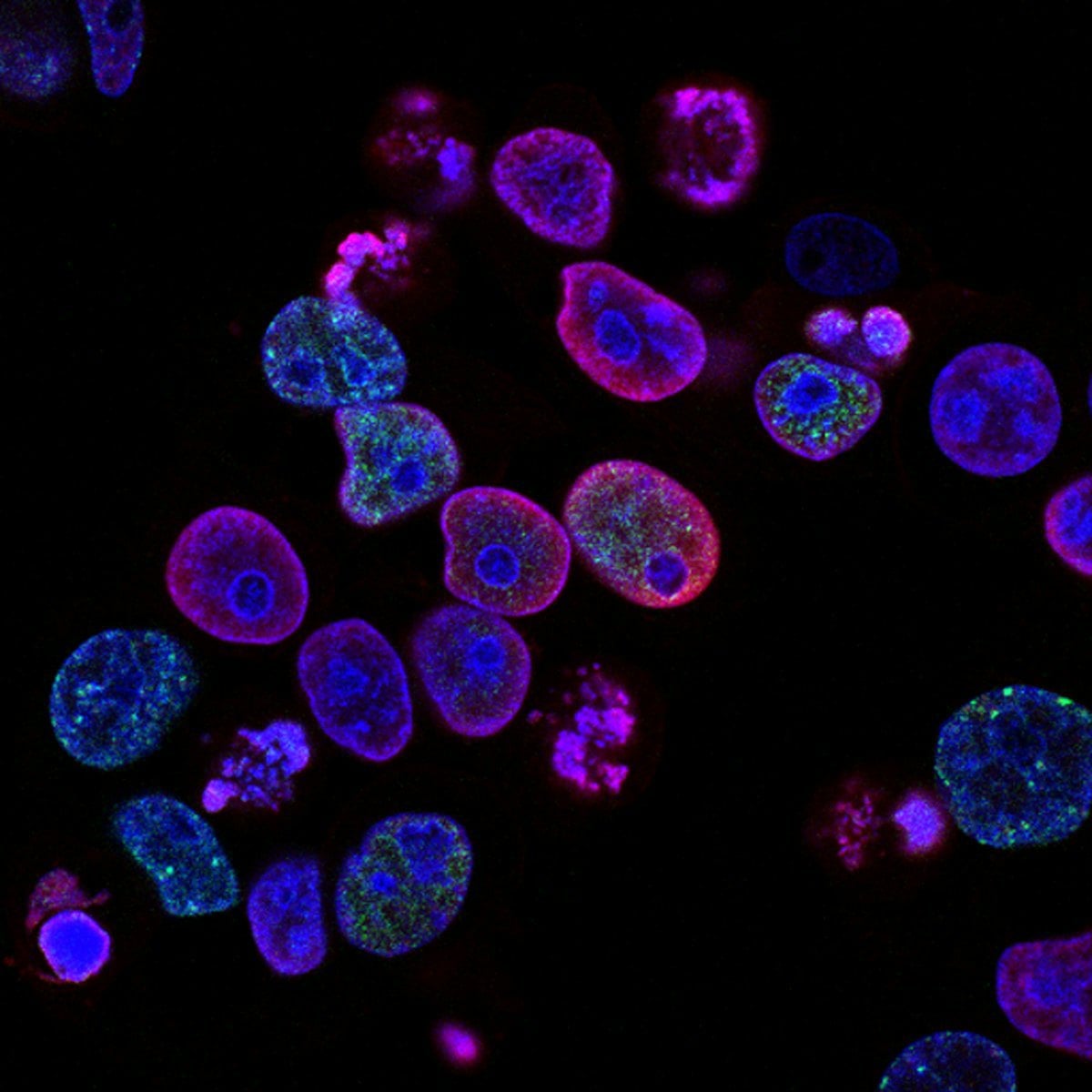 Microscópio em laboratório de análises clínicas