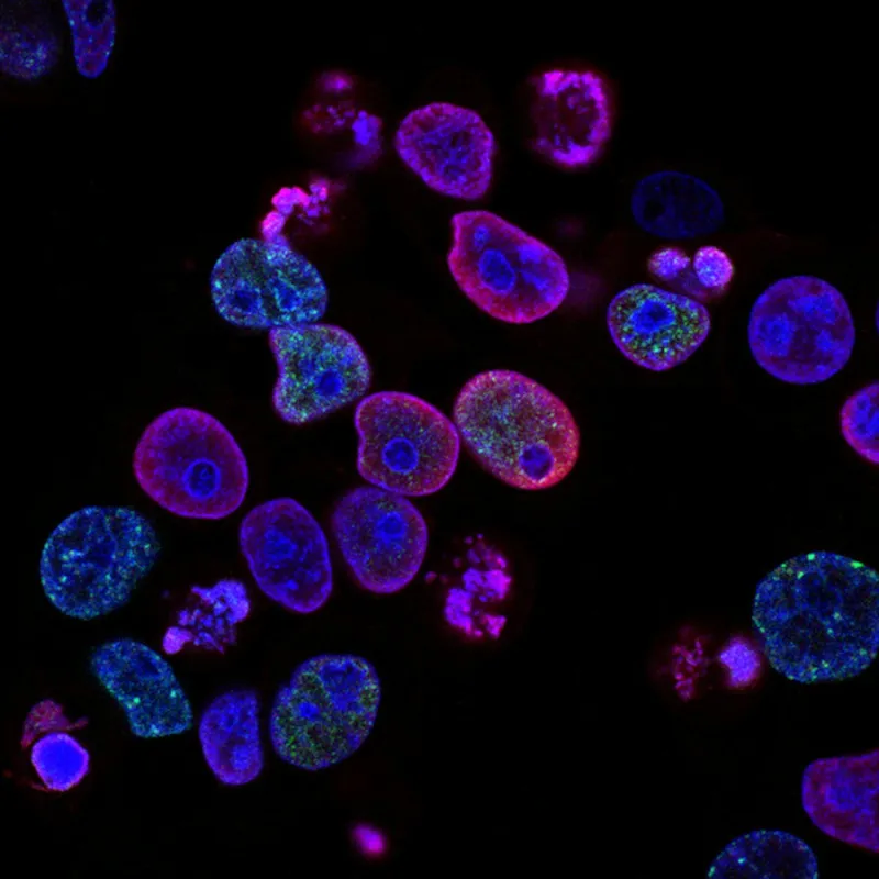 Microscópio em laboratório de análises clínicas
