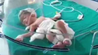 Bebê abandonada resgatada por cães de rua